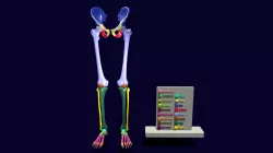 Lower Limbs With Girdle Color Coded