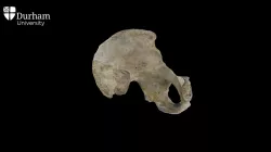 Os Coxa (Pelvis)