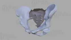 Pelvis-300061