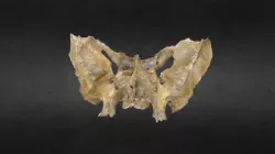 Esfenoides/Sphenoid Bone HD