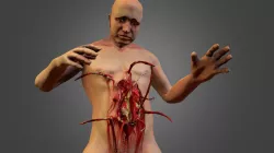 Human Chest Explode