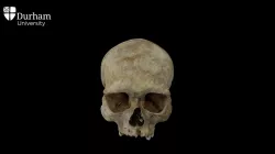 Male cranium with annotations