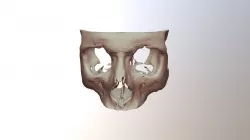 Skull form tac
