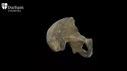 Pelvis with late-fusing epiphyses