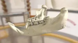 ChM CM987 - Porcupine Jaw