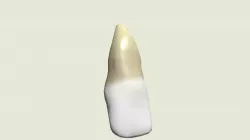 Incisor Test