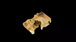 Thoracic Vertebrae Gun Shot Wound