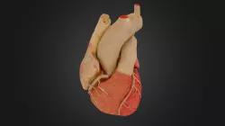 Heart Model
