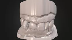 Occlusion JJ