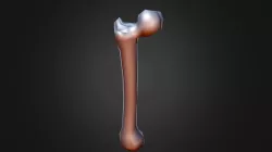 Femur