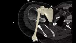right shoulder