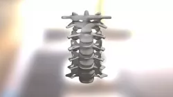 Vertebras Cervicales