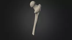 Femur