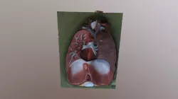 3D Lungs