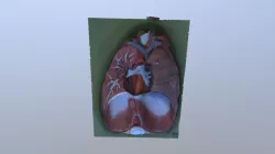 3D Lungs 2