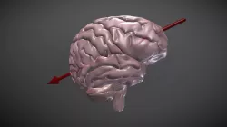 Bullet Trajectory through Brain