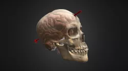 Bullet Trajectory through Skull and Brain