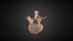 Human Lumbar Vertebra