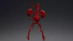 Abdominal aorta aneurism