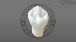300020 Mandibular 1st Premolar