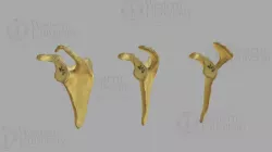 300099 Scapula -Three Versions of the Acromion