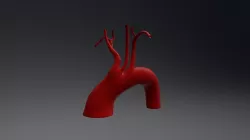 Bovine aortic arch
