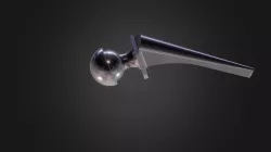 Hip Replacement