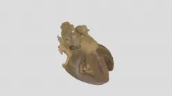 Truncus Arteriosus_A79107