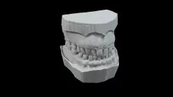 Dental Impression