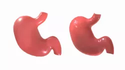 Stomach