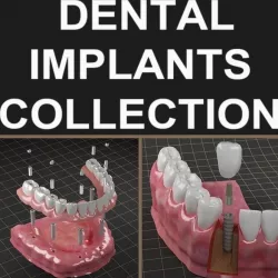 Dental Implant Collection 3D model