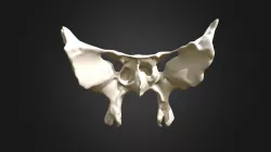 Sphenoid bone