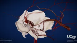 Vascular Components of the Petrous Face