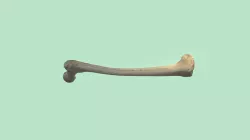 UD4 Femur