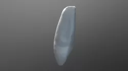 lateral incisor
