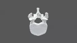 Thoracic Vertebra 9