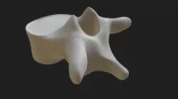 Anatomy - Human Thoracic Vertebra