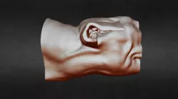 Dog CT scan edit