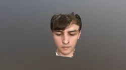 Epi