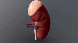 kidney