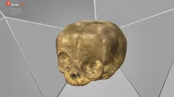 Young infant skull
