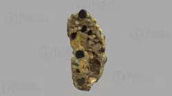 300100 Polycystic Kidney RP-02-34K