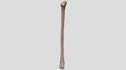 Fibula (Left)