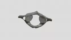 Human - cervical vertebra 1 (atlas)
