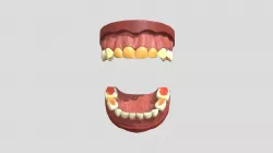 II