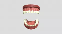II