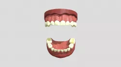II