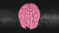 Injured 3D Printed Brain Model