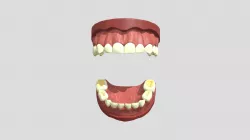 IV