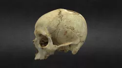 cráneo 3D